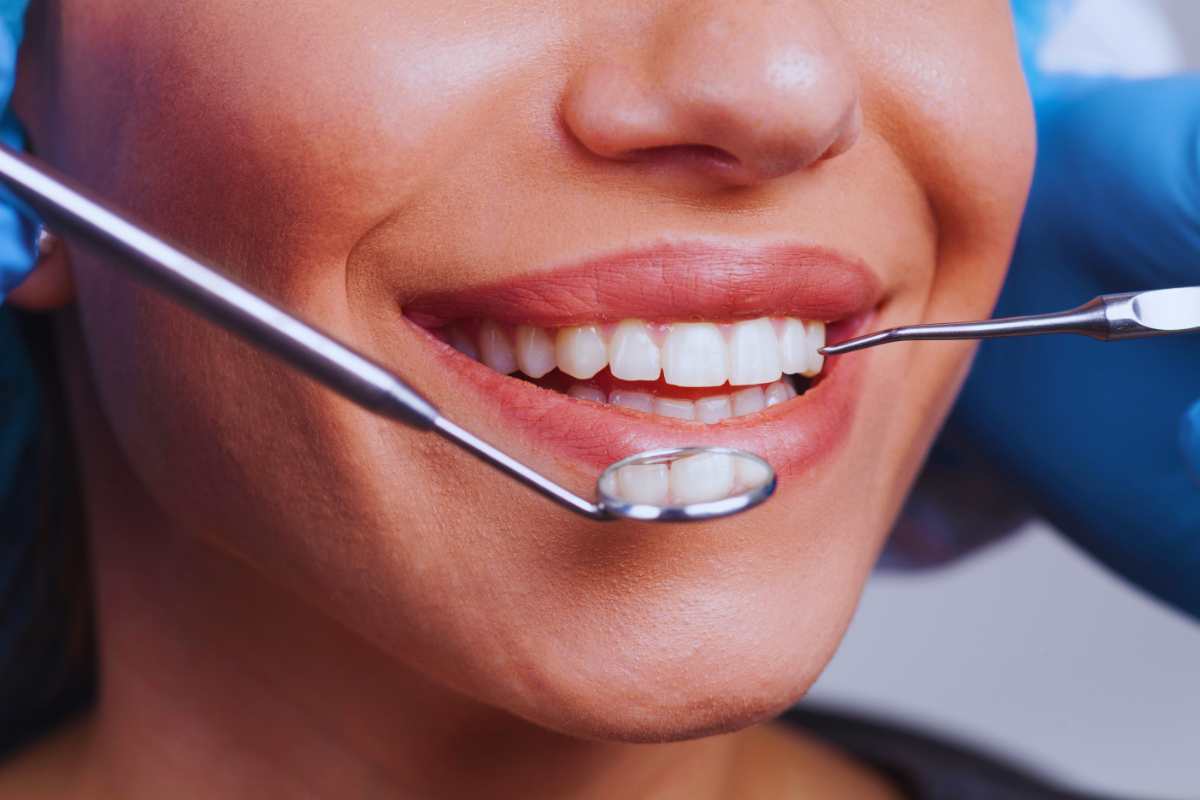 Nuovo bonus dentista, per quali visite non paghi più